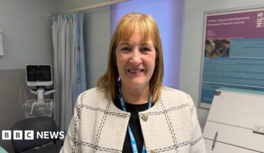 A woman wearing a light-coloured, checked jacket and an NHS lanyard stands in a hospital room. Medical equipment, a curtained area and information boards are visible in the background.