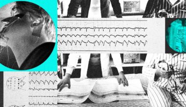 Technology Is Reshaping Sleep Apnea Treatment