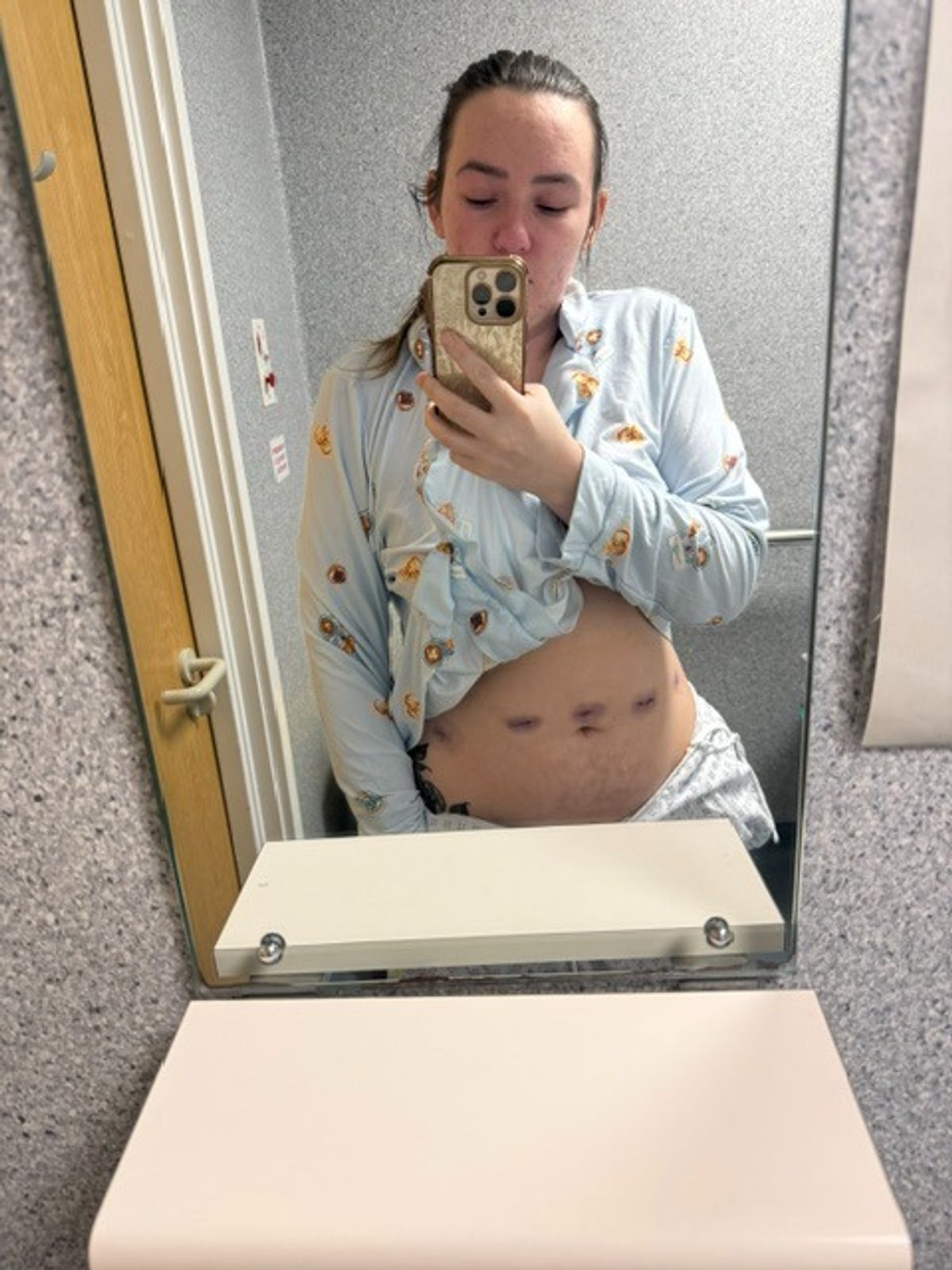 Courtney post-surgery