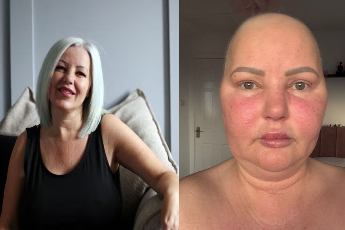 Emma Durkin following her diagnosis in 2022 (left) and as she is now (right)