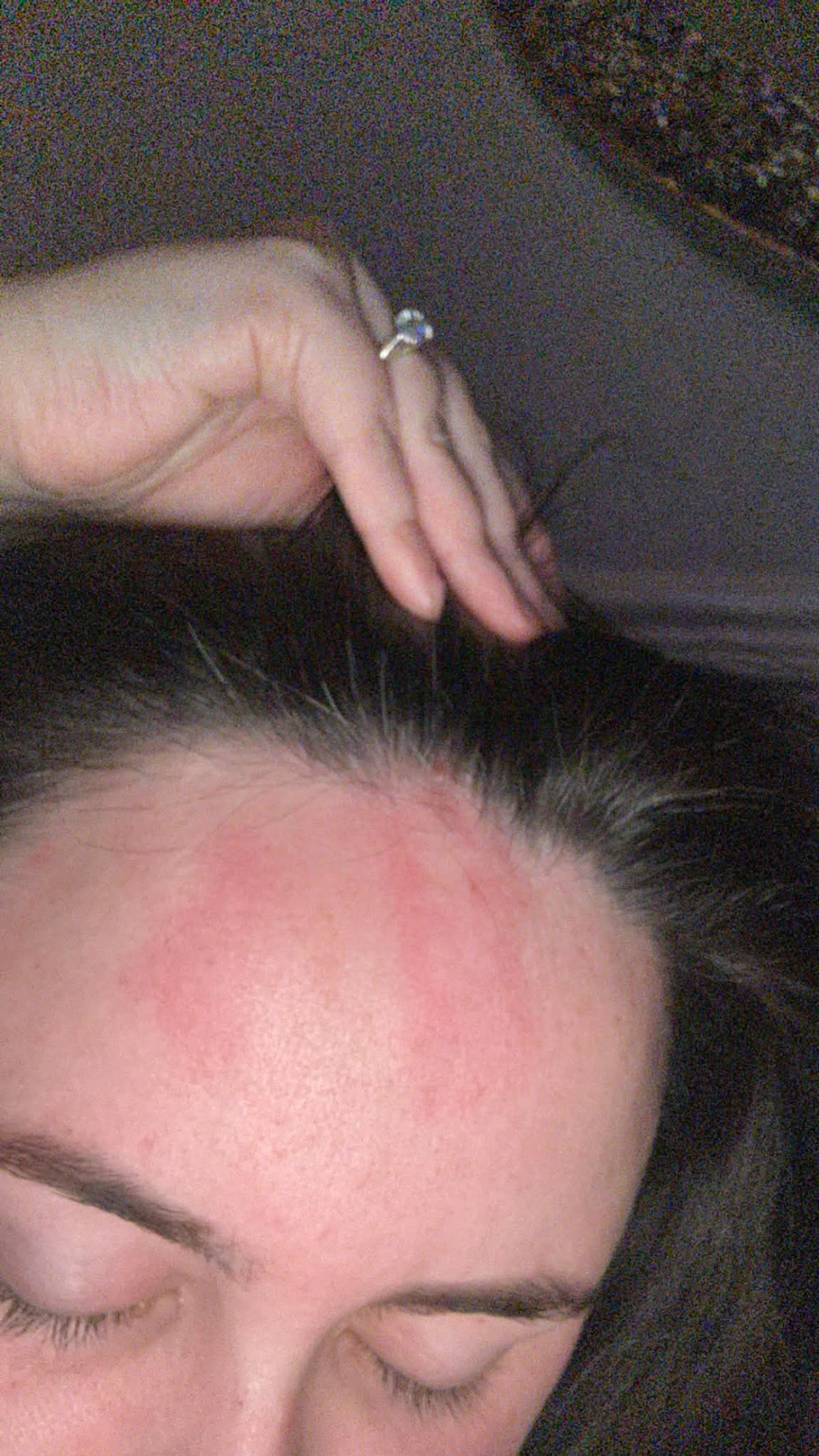 Torileigh New, 27, from Huyton, started ‘clawing her skin off’ after rashes started appearing on her body in April 2018