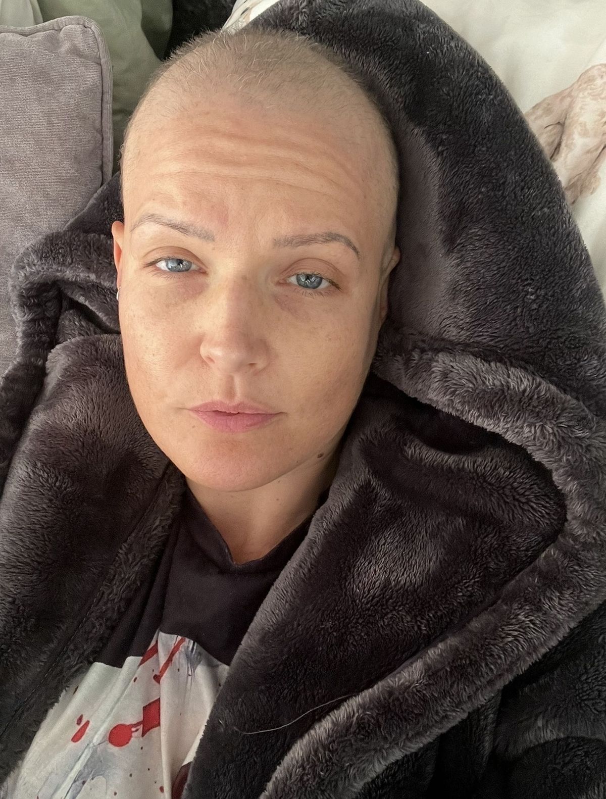 CLAIRE DANVERS, 39, DURING CHEMOTHERAPY TREATMENT.)