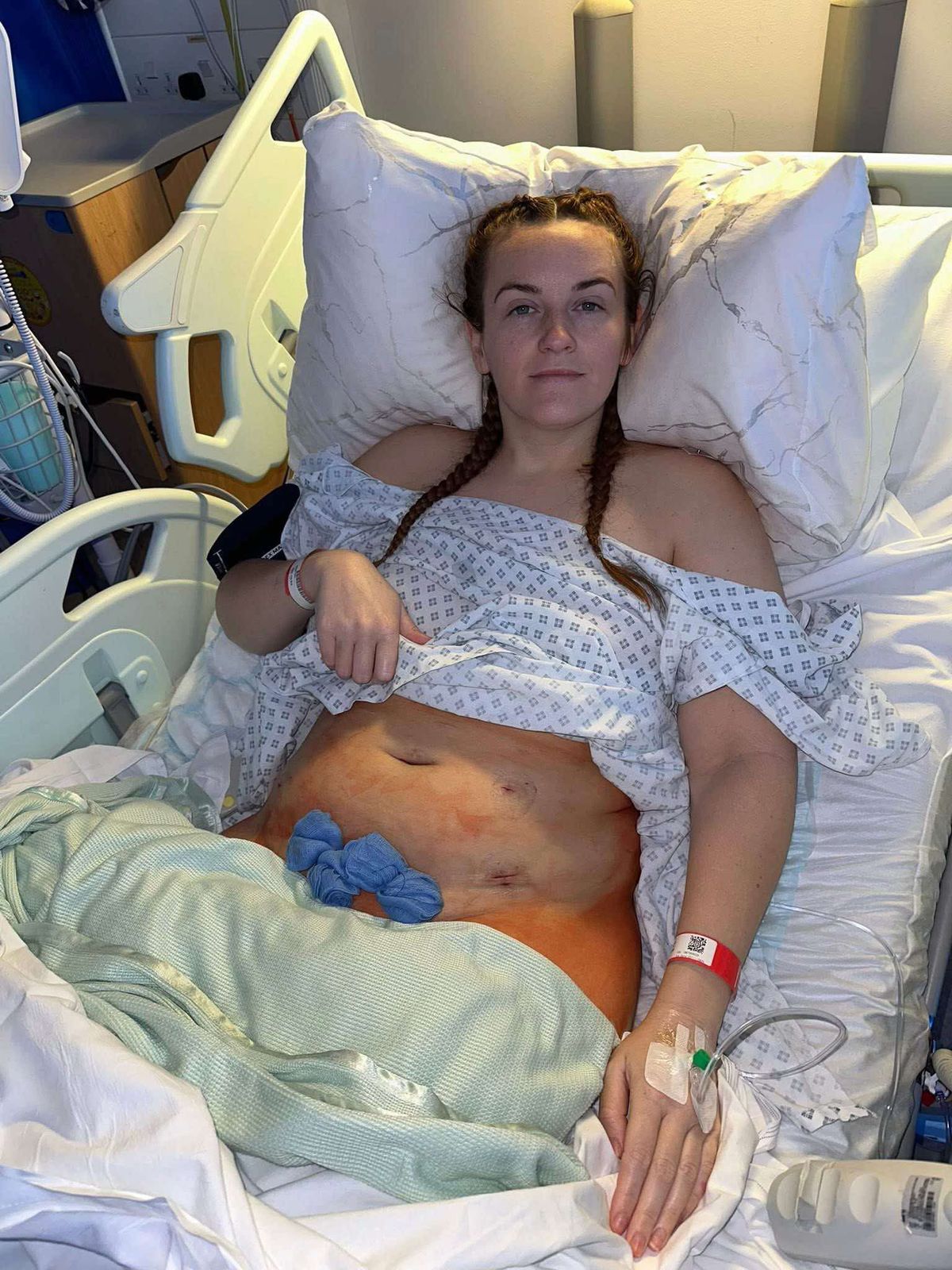 Jorja recovering after her surgery