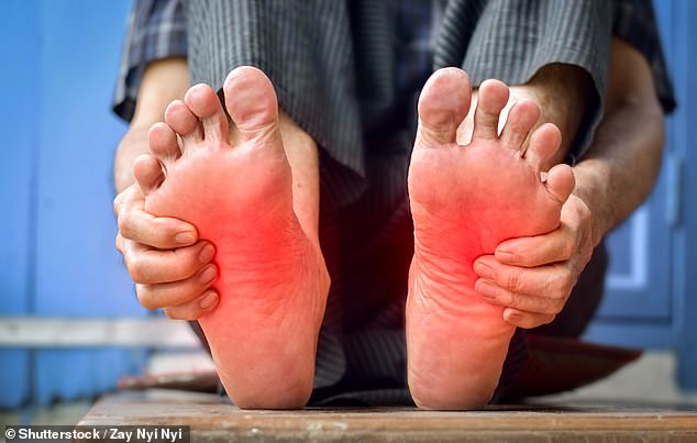A burning sensation in the feet is likely to be caused by a nerve condition called peripheral neuropathy