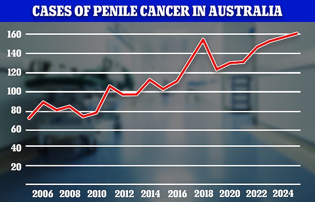 The rates of penile cancer are on the rise in Australia