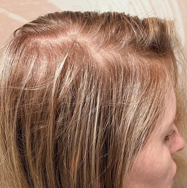 Everyone – myself included – has been suitably impressed with progress. Four months on, I am delighted with the regrowth and new growth