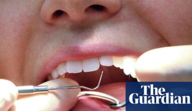 UK’s private dentistry market faces review after price jumps of up to 23% | Dentists