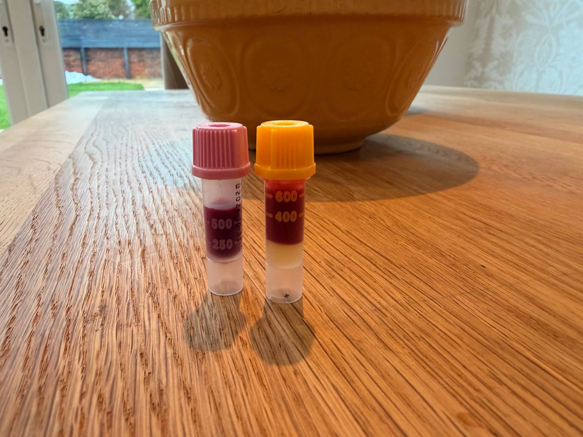 Two filled blood vials side by side on a kitchen table