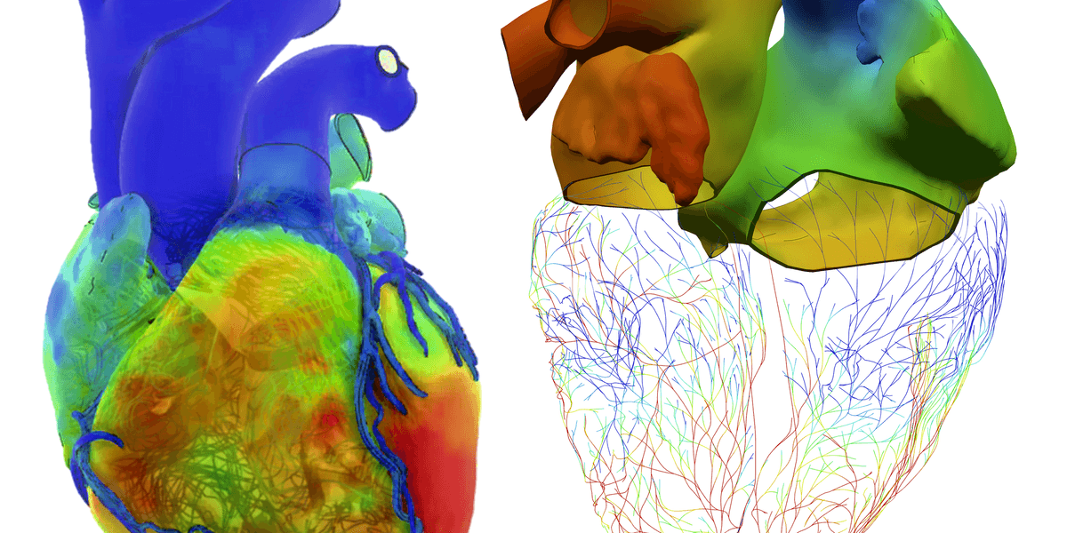 Living Heart Project Builds Virtual Twins for Medicine
