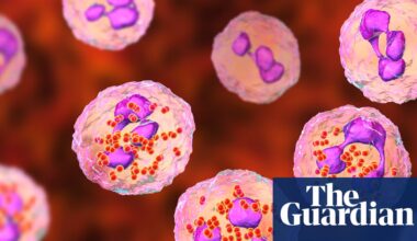 Experts consider expanding meningitis vaccine eligibility after Kent outbreak | Meningitis