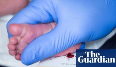 Scotland becomes first part of UK to screen newborns for spinal muscular atrophy | Scotland