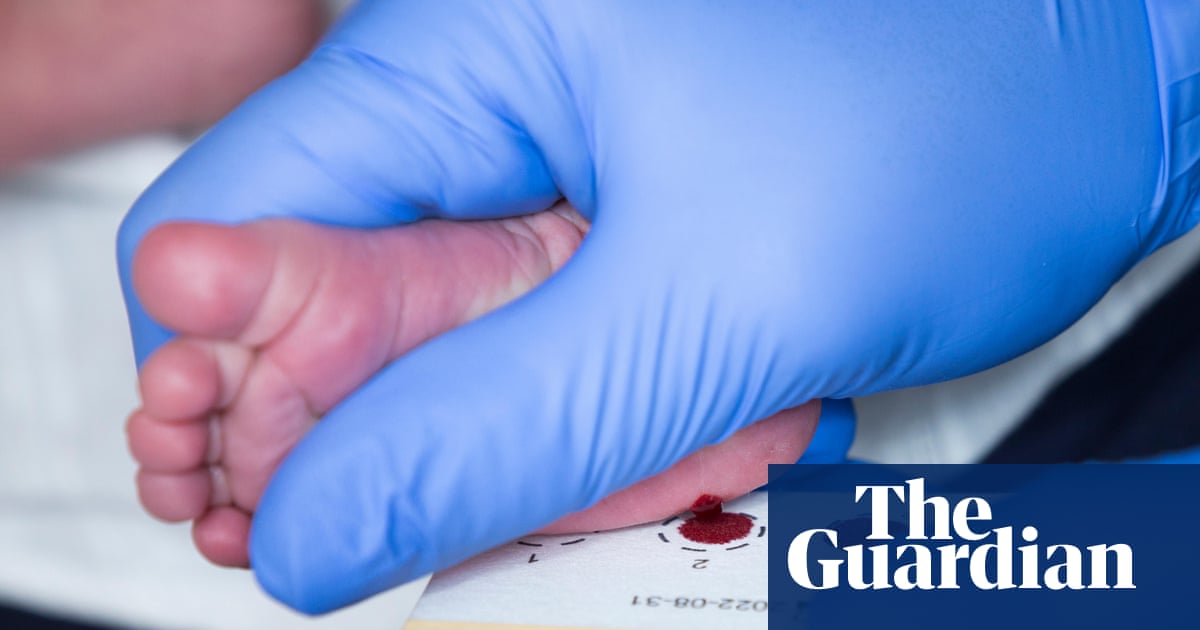 Scotland becomes first part of UK to screen newborns for spinal muscular atrophy | Scotland