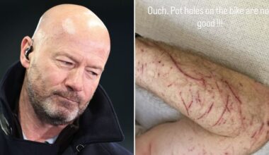 BBC pundit Alan Shearer suffers gruesome injuries after bike hits pothole in major crash