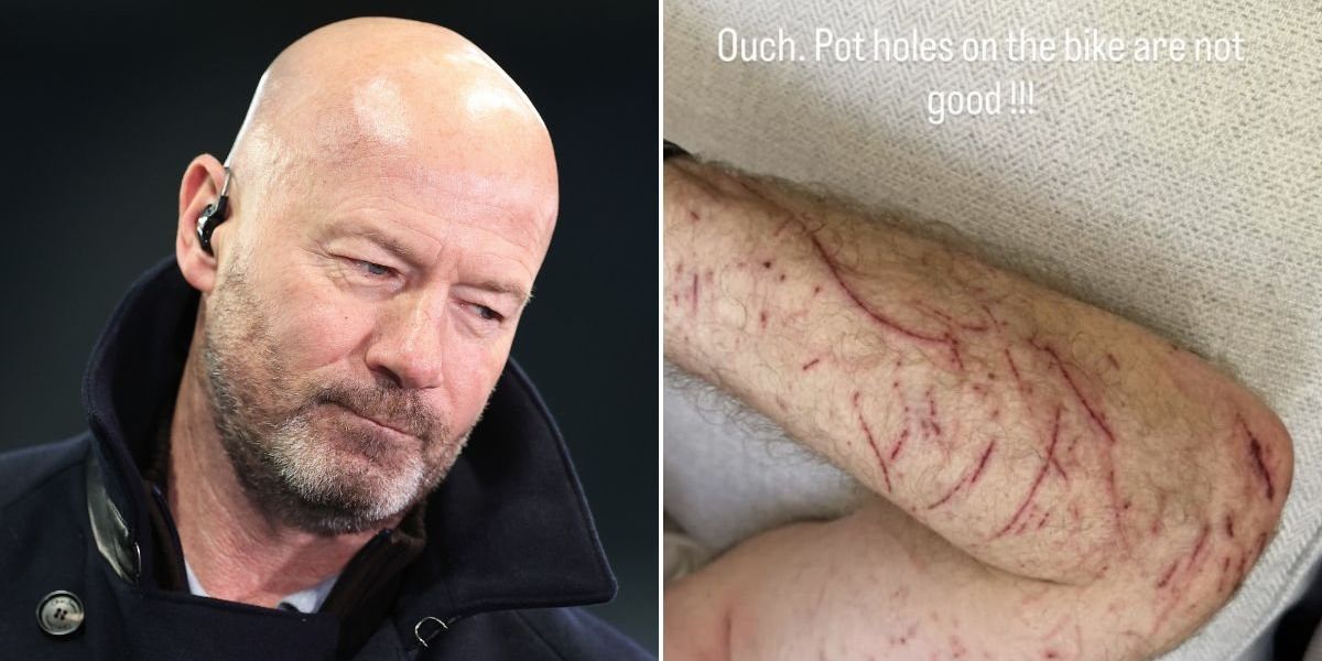 BBC pundit Alan Shearer suffers gruesome injuries after bike hits pothole in major crash