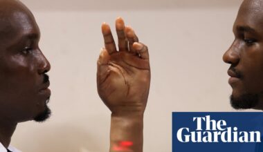 ‘Prosthetics aren’t made for people like us’: the brothers creating innovative artificial limbs for Africans | Global development