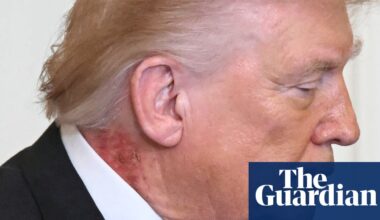 Trump neck rash from ‘preventative’ skin treatment, White House says | Donald Trump