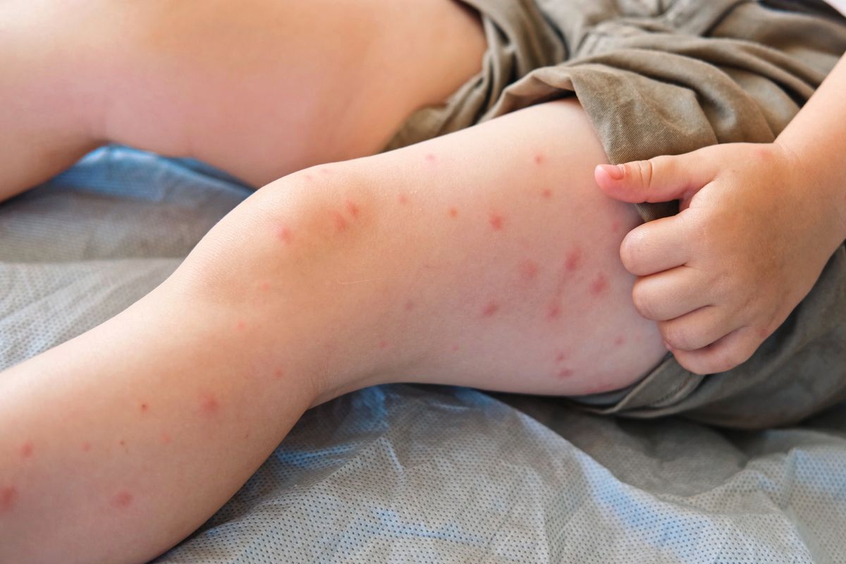 Child with Red Rash being Examined at the Physician