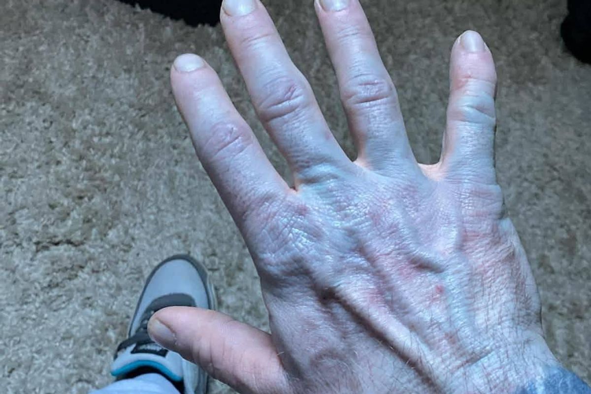 Tommy woke up bright blue