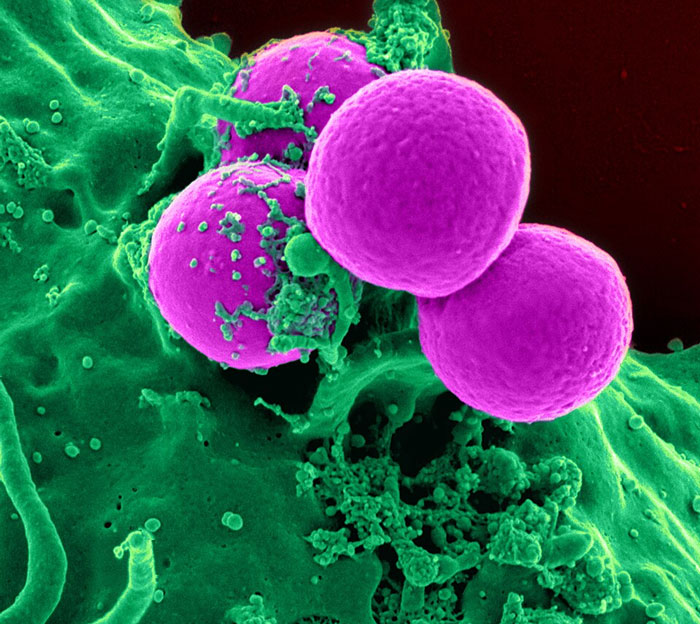 Close-up microscopic image of disease-causing cells highlighting diseases people should fear more according to doctors.