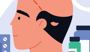 We Need to Talk About Finasteride – and Growing Concerns Around the Hair-Loss Drug