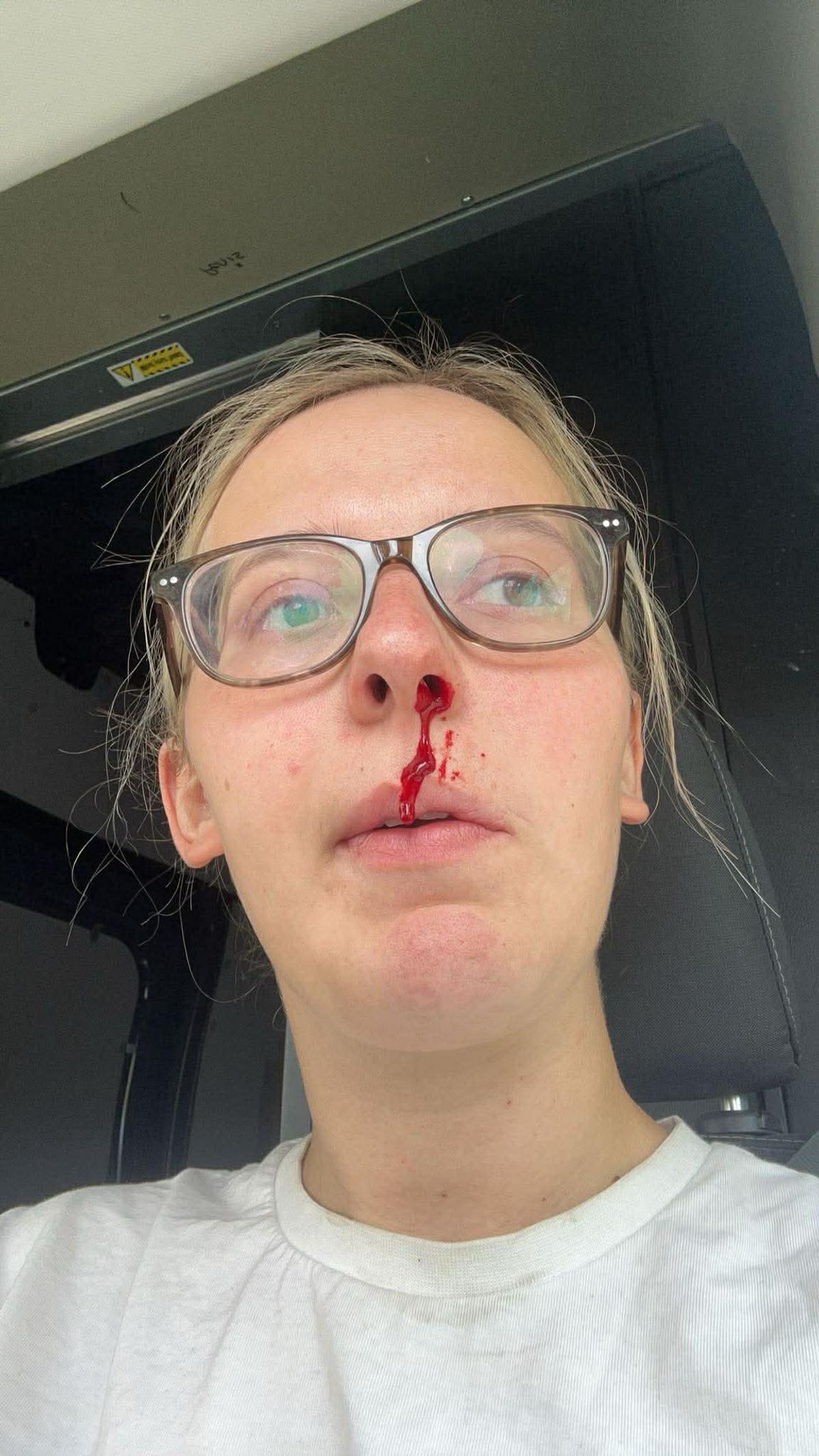 She still suffers from difficult days and two years ago ended up in hospital from a stress related seizure. 