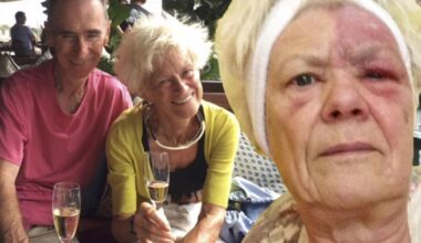 ‘A red dot was first sign of illness that caused pain for 13 years'