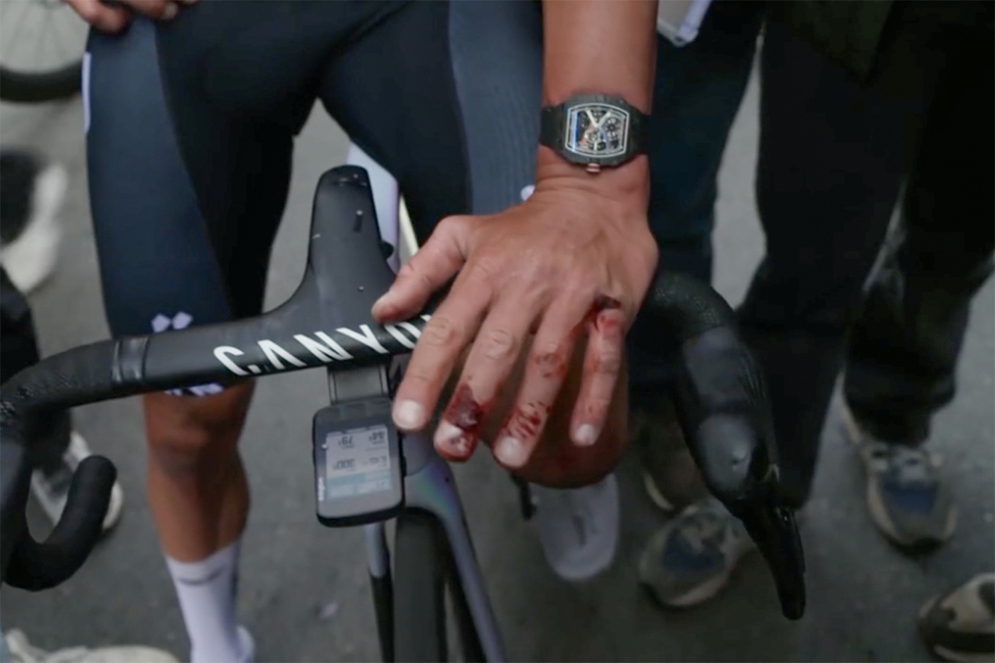 Mathieu van der Poel's Milan-San Remo 2026 finger injury (Het Laatste Nieuws)
