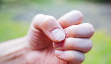 What changes to your fingernails can reveal about your health