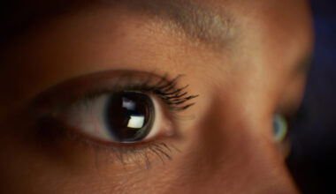 Why are vertebrate eyes so different from those of other animals?