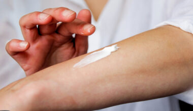 Scientists Uncover The Nerve Pathway That Makes Stress Worsen Eczema : ScienceAlert