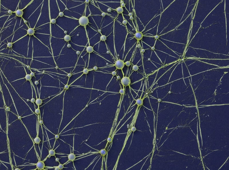 A network of green, web-like neural cells with round centers interconnected by thin strands, set against a dark blue background, resembling a complex biological or neural network.
