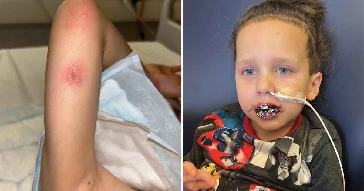 My son was so ill he couldn't drink water - doctors sent us home