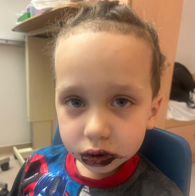 Rachel Tompkins ATT - Elaine Adams: Docs thought was Hand Foot and Mouth - but rare condition could have blinded my son