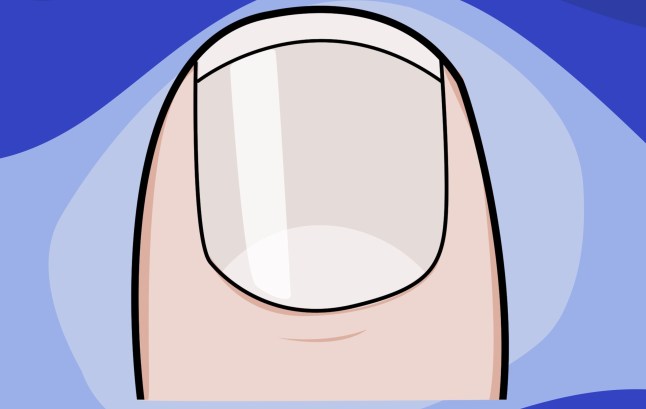 What your fingernails can tell you about your health example: pale Picture: Myles Goode