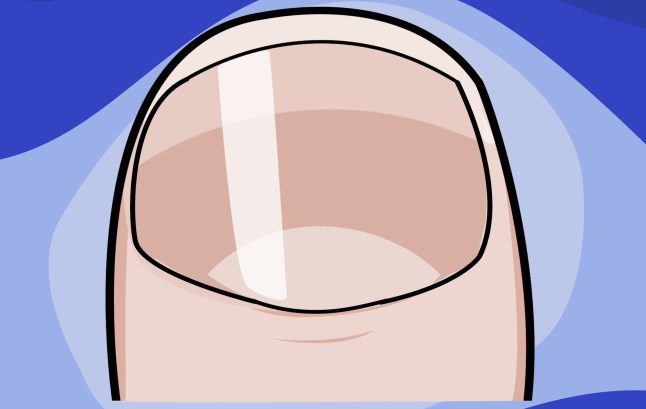 What your fingernails can tell you about your health example: spoon Picture: Myles Goode