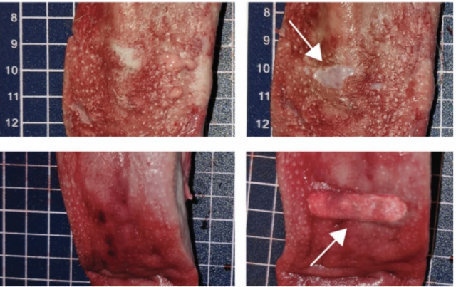 Example of tongue tissue damage following detachment