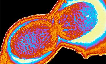 Epidemiological update - 18 March 2026: Shigellosis and other gastrointestinal infections in travellers returning from Cabo Verde