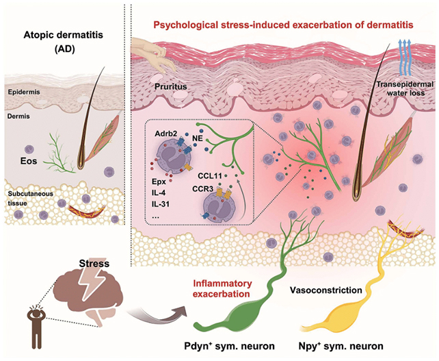 Skin rash graphic