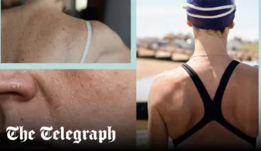 From runner’s face to swimmer’s sunburn: How exercise affects your skin