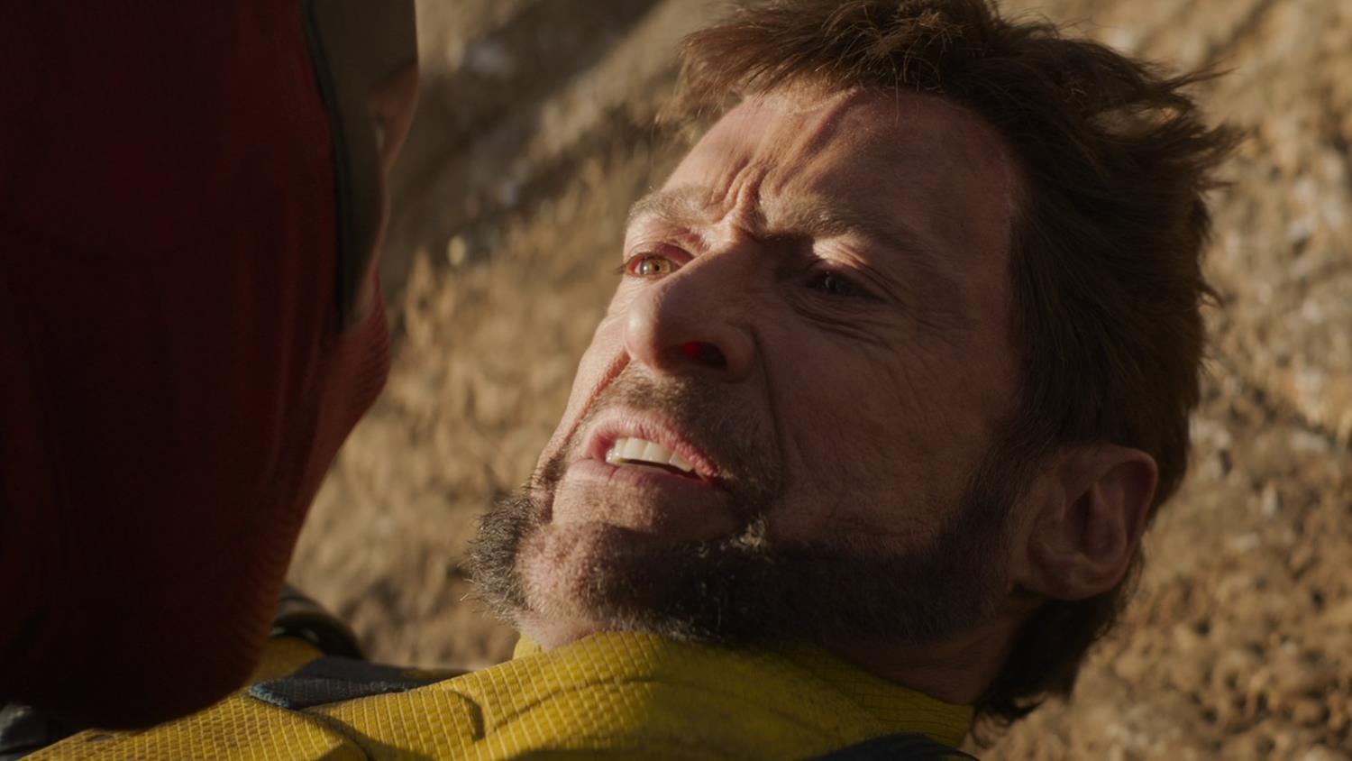 "Should Hugh Jackman Return as Logan?"