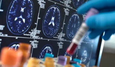 Breakthrough Alzheimer’s drugs to be reconsidered for NHS