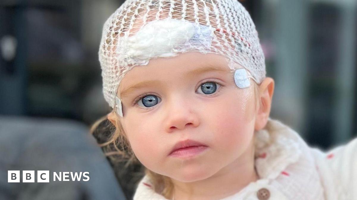 Tilly looks into camera with hospital dressings on her head at Sheffield Children's Hospital.