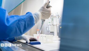 Meningitis: Officials reassure parents suspected case not linked to Kent outbreak