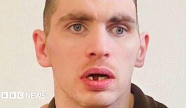 Jordan Jones looking at the camera, his mouth is open and a lower tooth is missing.