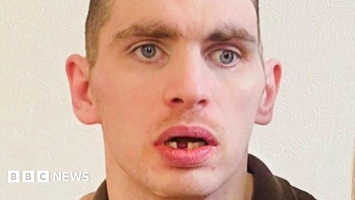 Jordan Jones looking at the camera, his mouth is open and a lower tooth is missing.