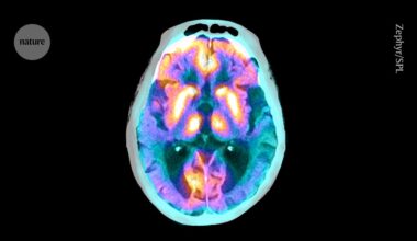 These brain cells clear proteins that contribute to Alzheimer’s