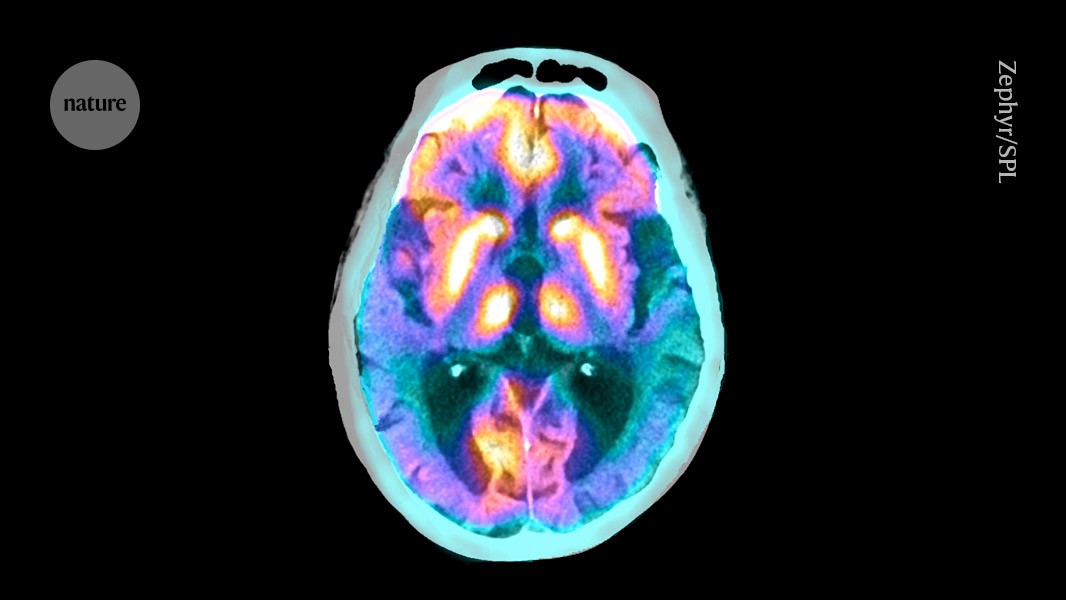 These brain cells clear proteins that contribute to Alzheimer’s