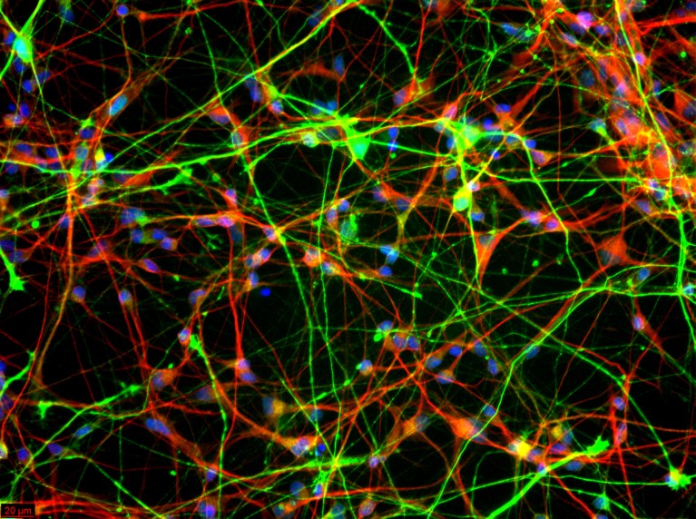 Micrograph of neurons that look like glowing tangled threads.