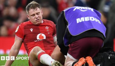 Sam Costelow receives treatment after injury against Scotland