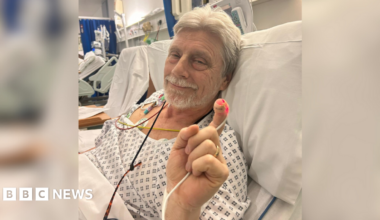 The image shows an elderly man lying in a hospital bed wearing a hospital gown' there are tubes coming out of his shoulder and one connected to his finger, which he is holding up.